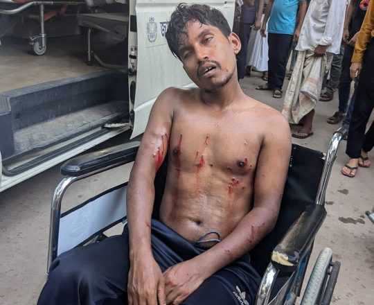 পুলিশের হামলায় জাবি শিক্ষার্থী আহত।