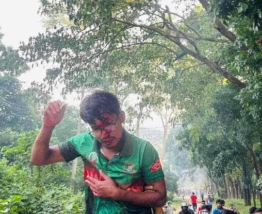 জাবিতে পুলিশ এর হামলা,শিক্ষার্থী আহত।